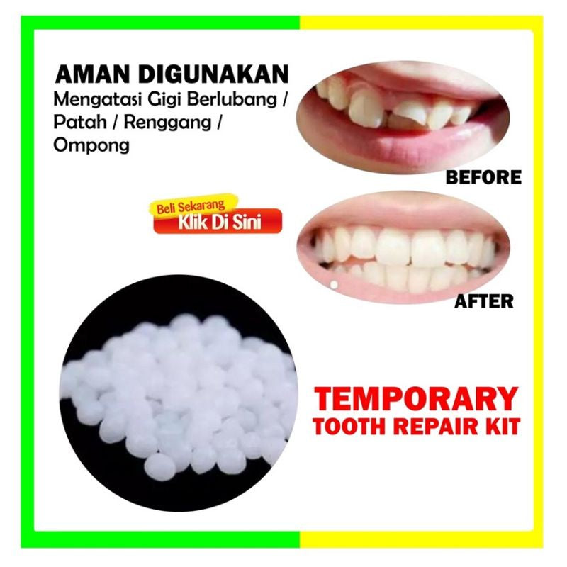 Pekanbaru [ Promo 200 Butir ] Penambal Gigi Ompong Temptooth Murah / Gigi Palsu