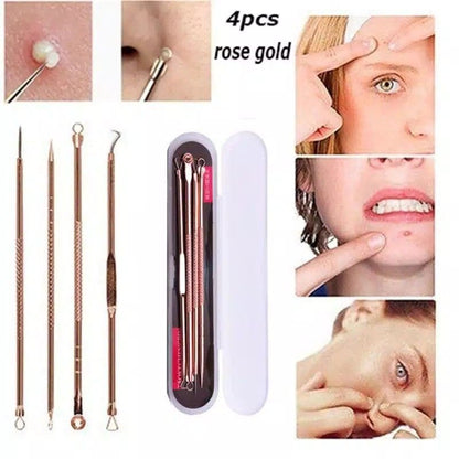 Pekanbaru Pinset Komedo Set 4 In 1 Free Kotak Stainless Steel - Pencet Jerawat- Blackhead